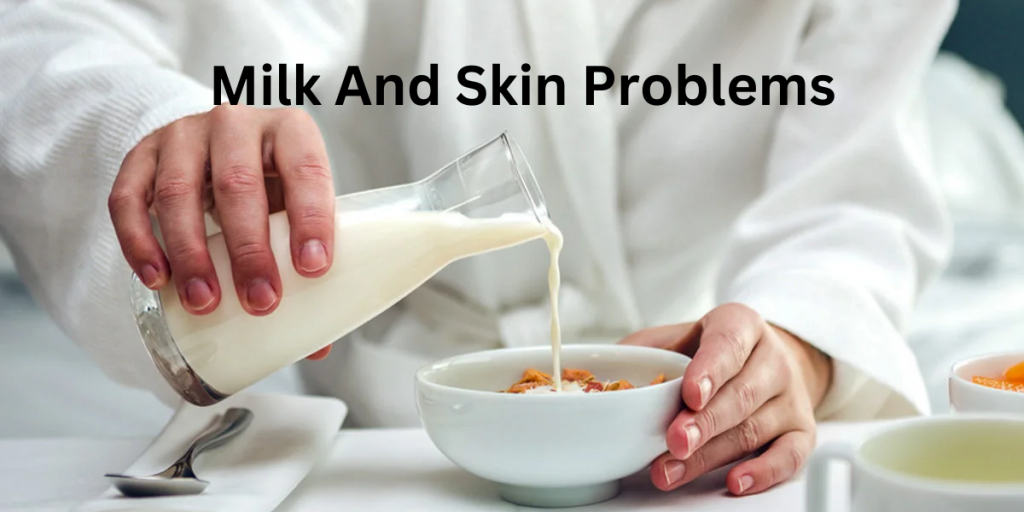 مشاكل الحليب والجلد